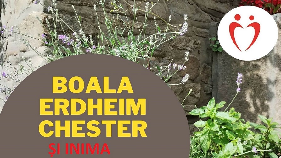 Boala Erdheim Chester (1)